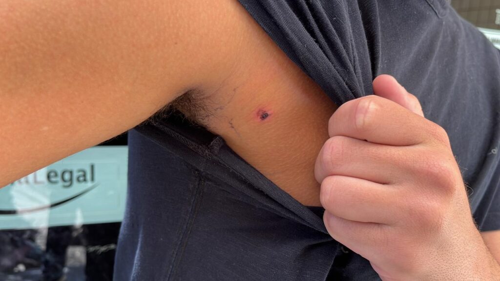 Adolescente é atingido por tiro de chumbinho dentro de condomínio no Rio